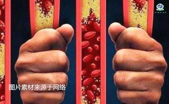 不想給血管“添堵”，盡量少吃以下這些東西，或許能讓腦梗離遠(yuǎn)些  